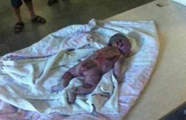 dog kills baby in uttar pradesh hospital