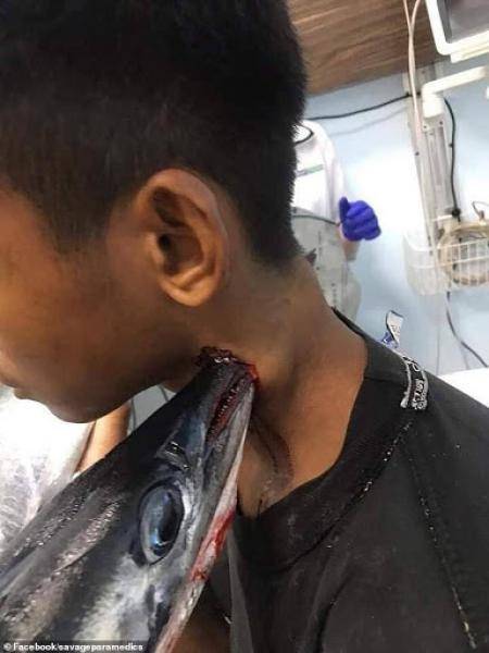  Indonesia boy in critical condition after fish attack