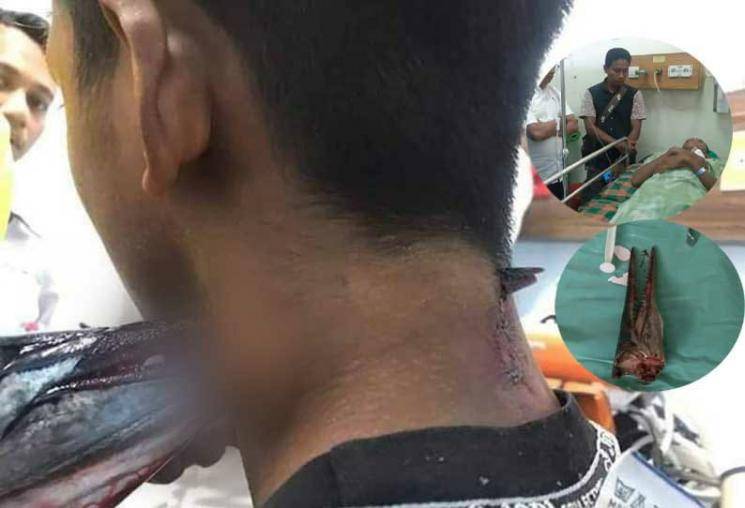  Indonesia boy in critical condition after fish attack