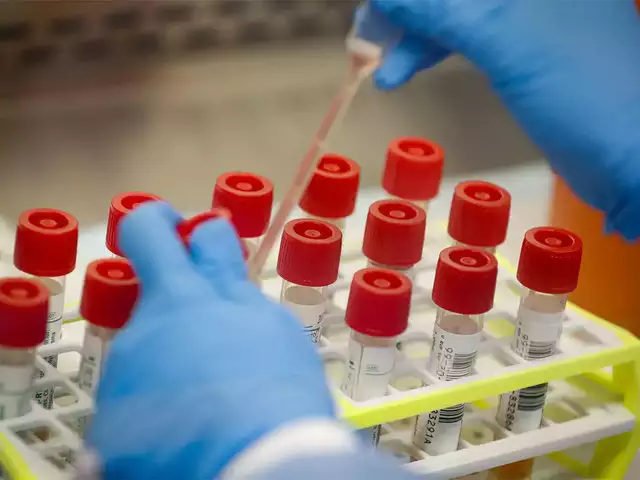Coronavirus China concerned India cancels rapid test kits orders