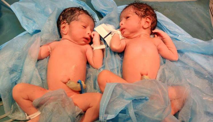 Coronavirus positive woman gives birth to twin girls at Hyderabad hospital